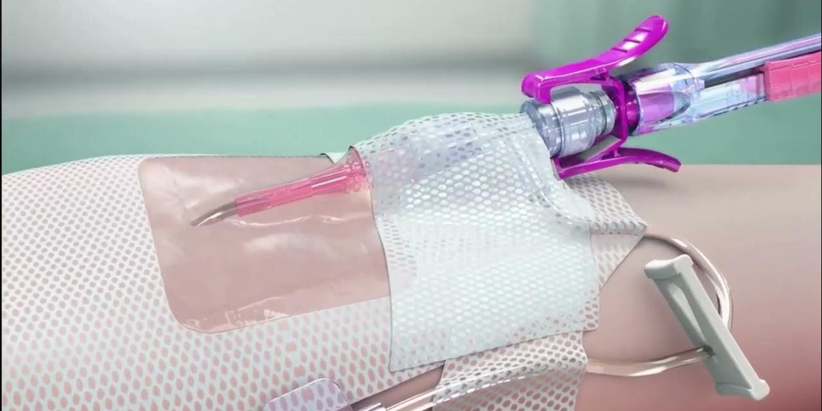 From US$8.71 Billion to US$14.02 Billion: How the Blood Collection Devices Market Is Scaling Fast