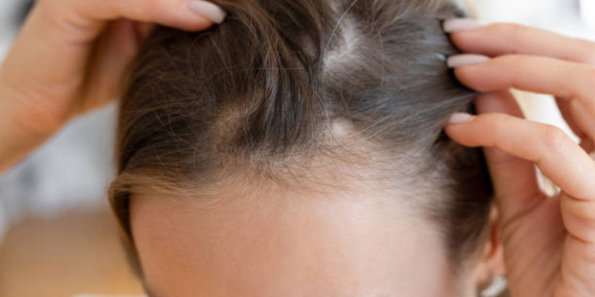 The Importance of Hair Follicle Health in Restoration Procedures